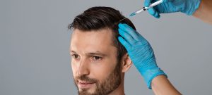 PRP Hair Loss Therapy