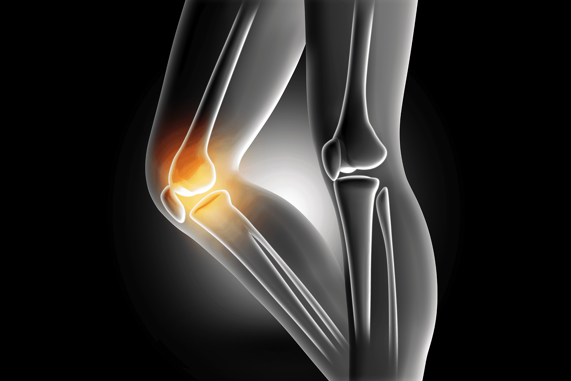 Knee-pain-renew-medical