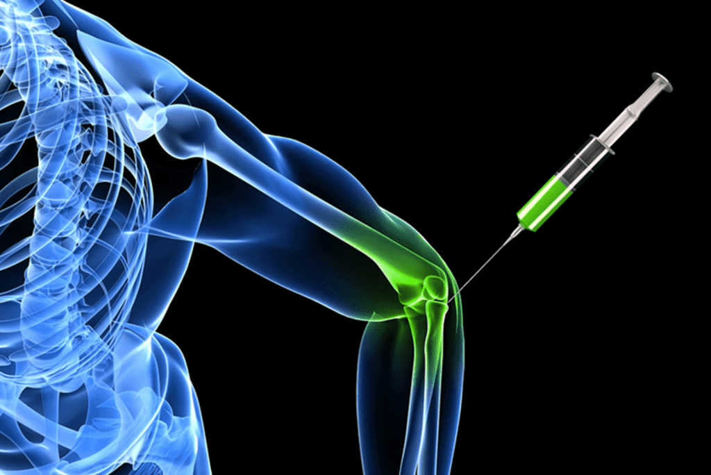 Best Neural Prolotherapy (NPT) for Nerve Pain in Cincinnati Ohio