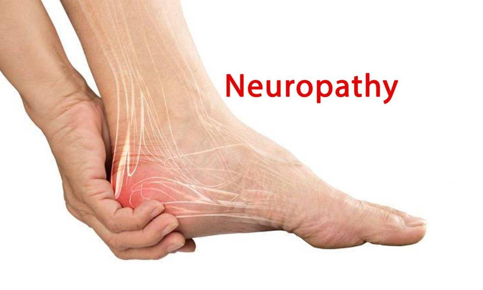 Peripheral Neuropathy: treatment Cincinnati