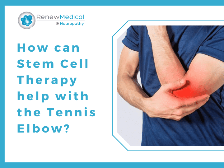 How can Stem Cell Therapy help with the Tennis Elbow?