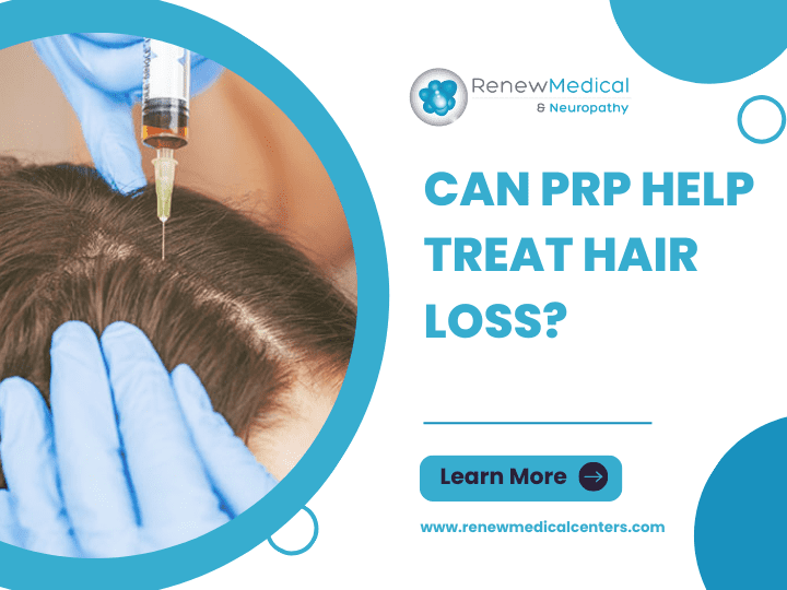 Can PRP Help Treat Hair Loss?